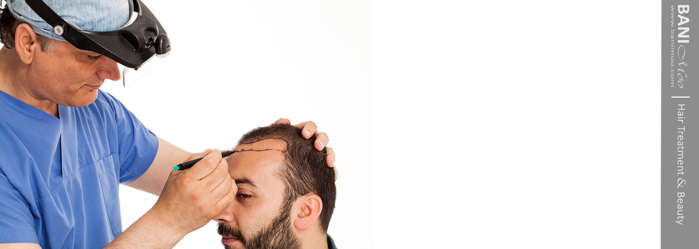 کاشت مو ایران بانیمو | FIT hair transplant Iran Banimoo